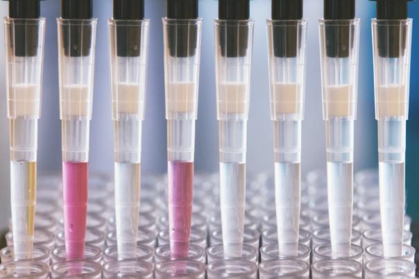 UK Biobank Develops a Multi-Modal AI Foundation Model to Advance Precision Medicine