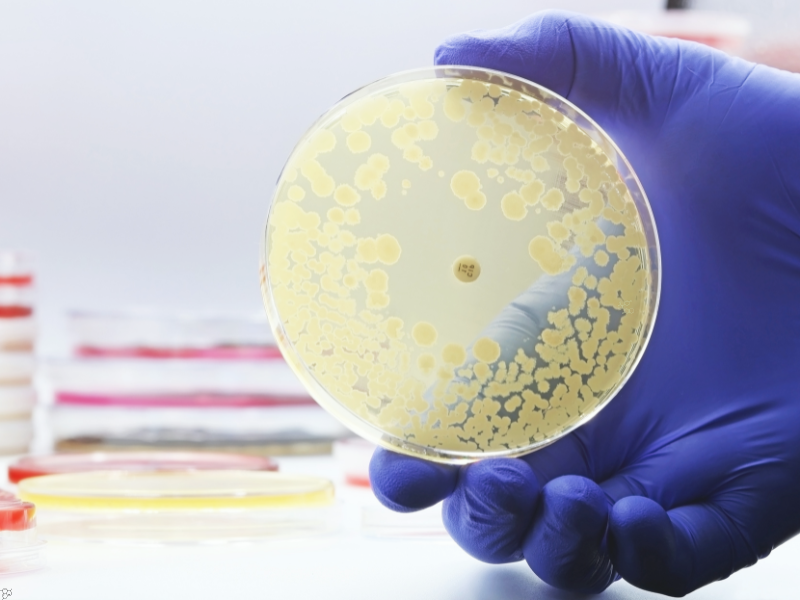 Lucy Shapiro wins Lasker Award for Uncovering Spatial Organisation in Bacterial Cells 