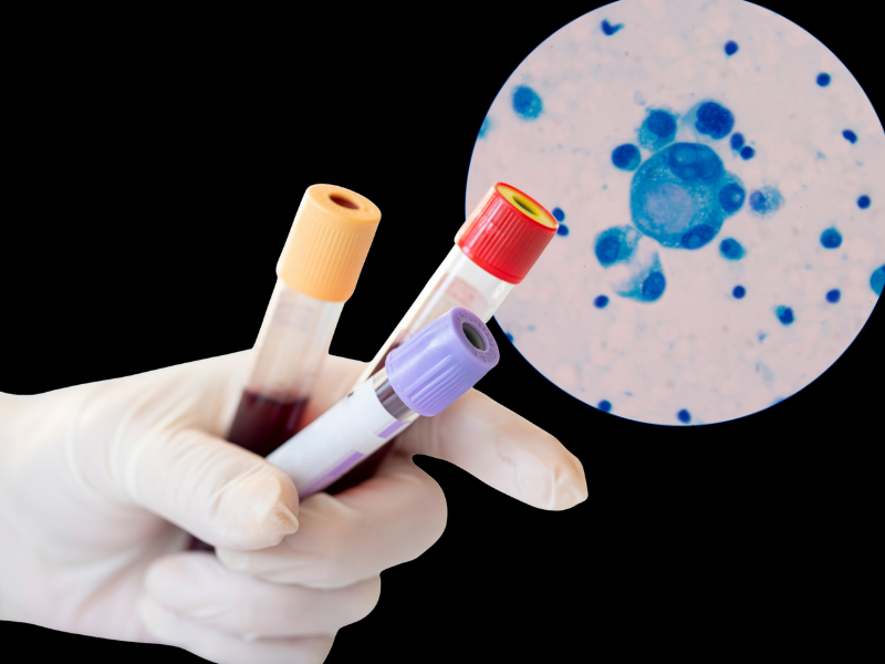liquid biopsy