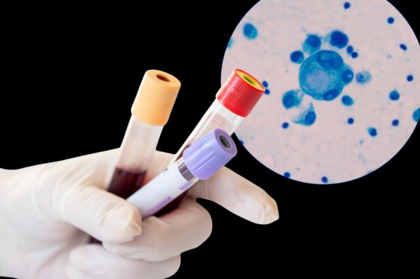 liquid biopsy