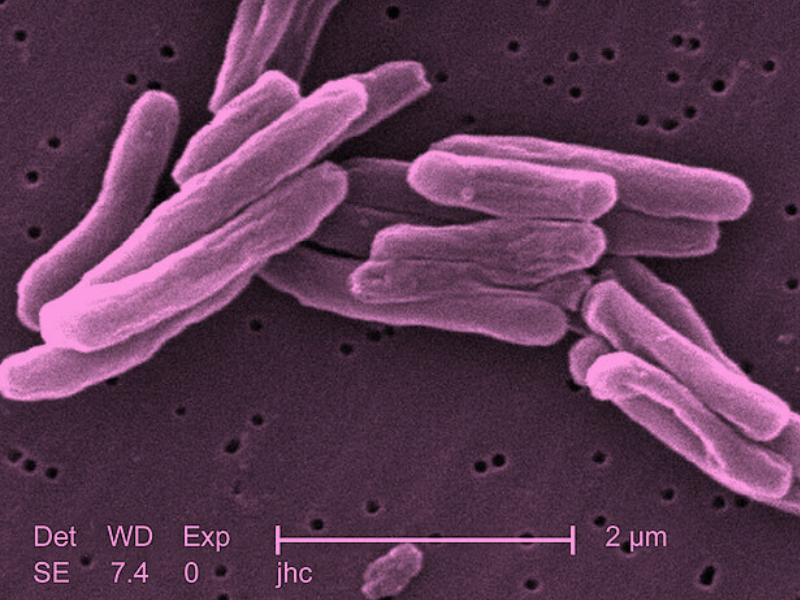 tb bacteria