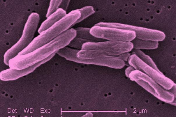 tb bacteria