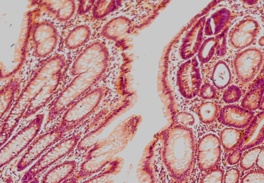 Spatial Biology 3 (2)