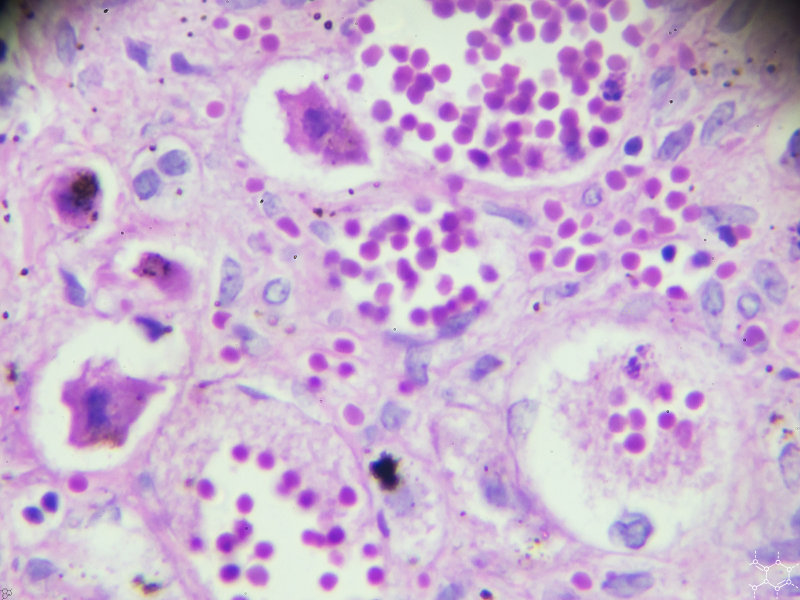 Featured image with circle  (96)