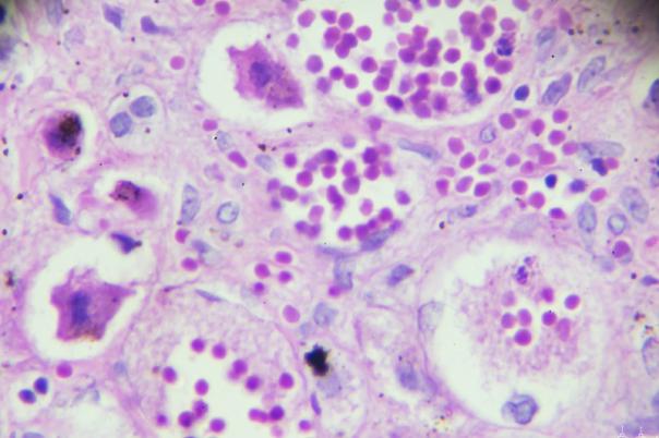 Featured image with circle  (96)