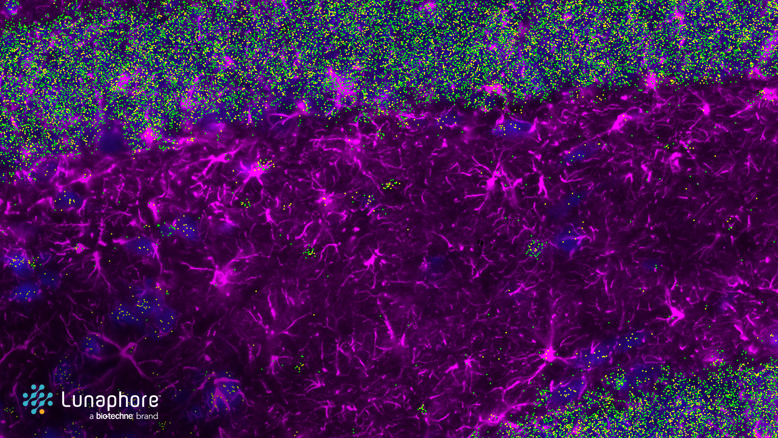 WhitePaper: Take a closer look at ALS through spatial multiomics on COMET™