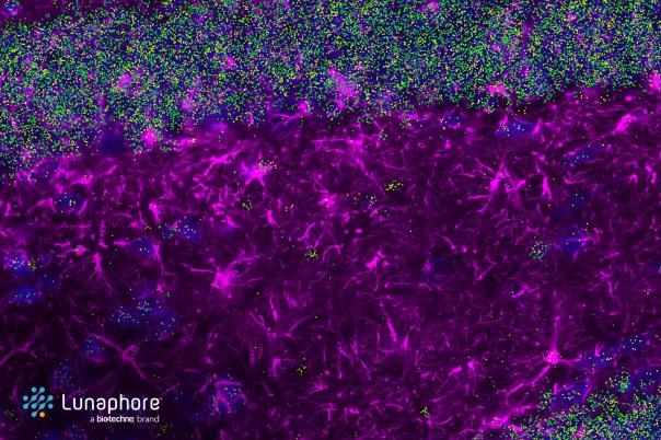 WhitePaper: Take a closer look at ALS through spatial multiomics on COMET™