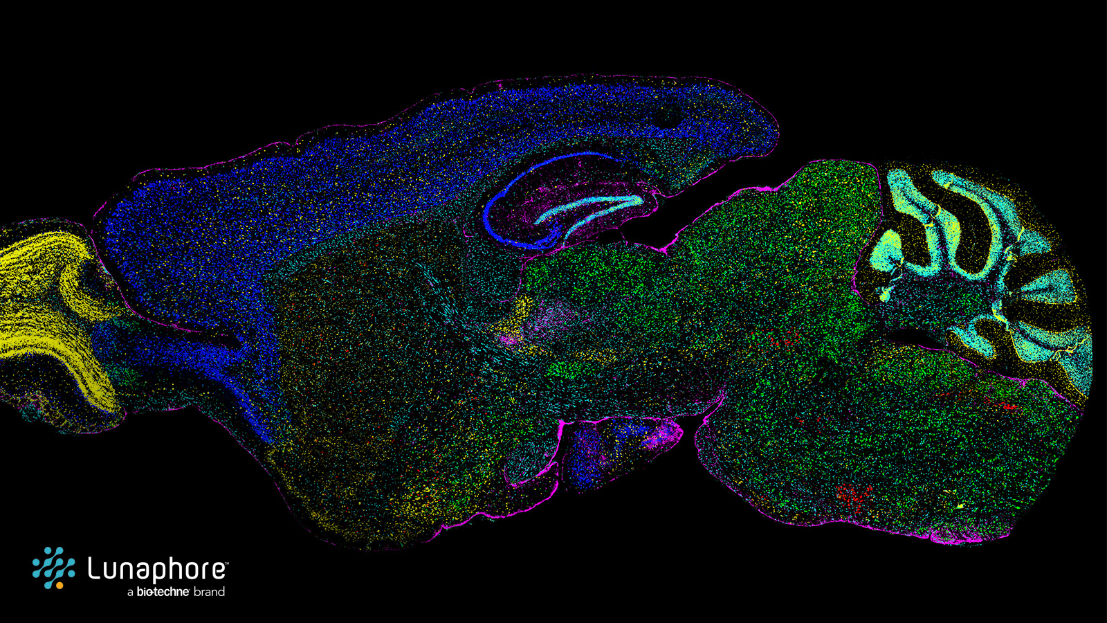 Spatial multiomics on COMET™ lets you see the brain differently