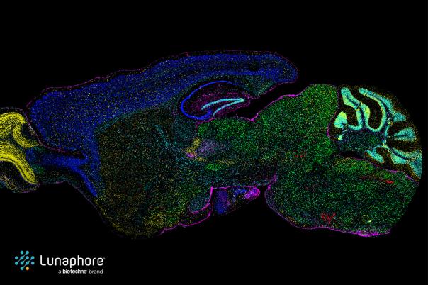 Spatial multiomics on COMET™ lets you see the brain differently