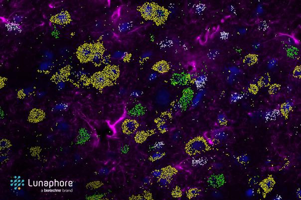 A visual walkthrough same-section RNA and protein detection on COMET™ 