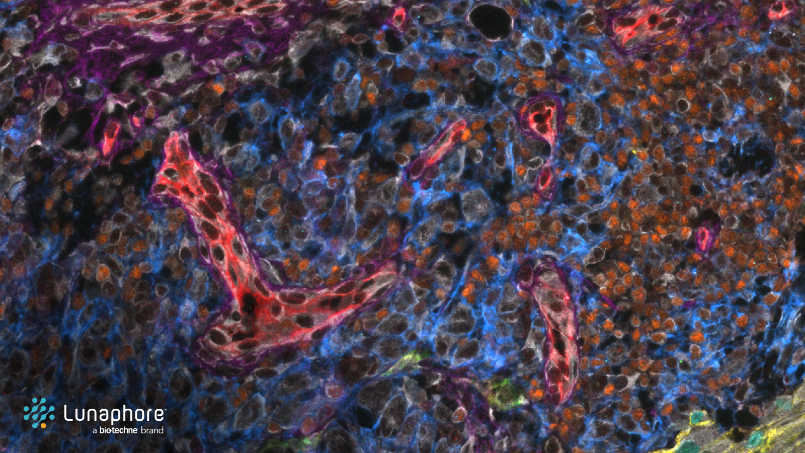 Real-world applications that turn spatial biology ideas into insights