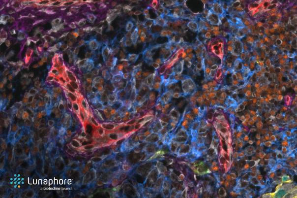 Real-world applications that turn spatial biology ideas into insights