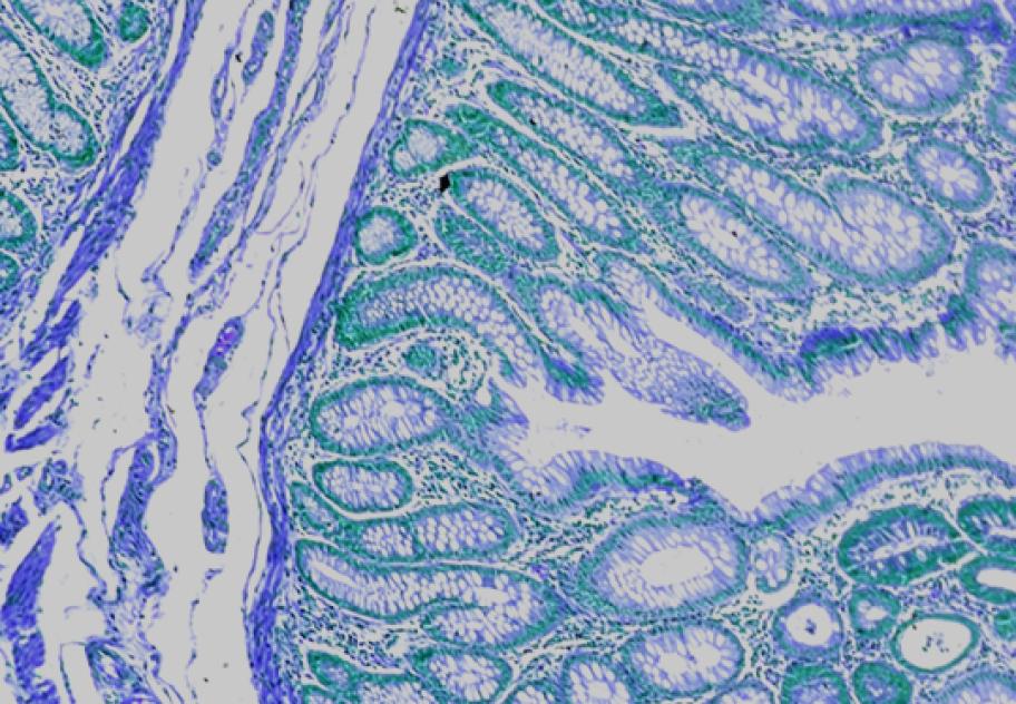 PANEL DISCUSSION: Spatial Biology To Advance The Map Of Human Pathology